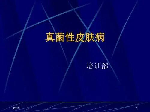 真菌性皮肤病分析ppt课件