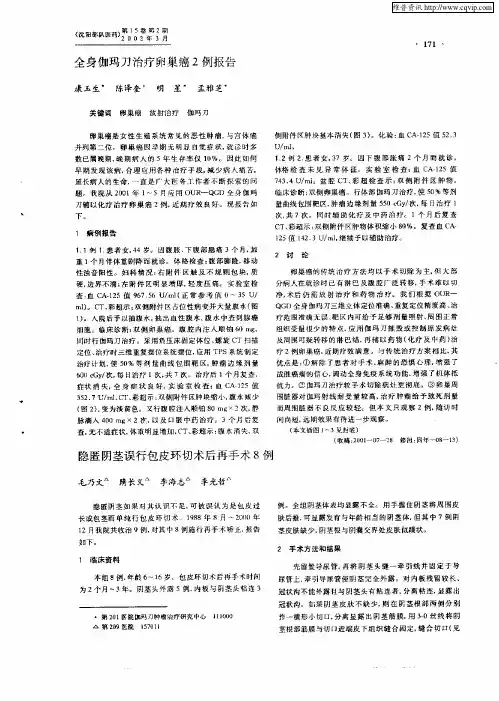 全身伽玛刀治疗卵巢癌2例报告