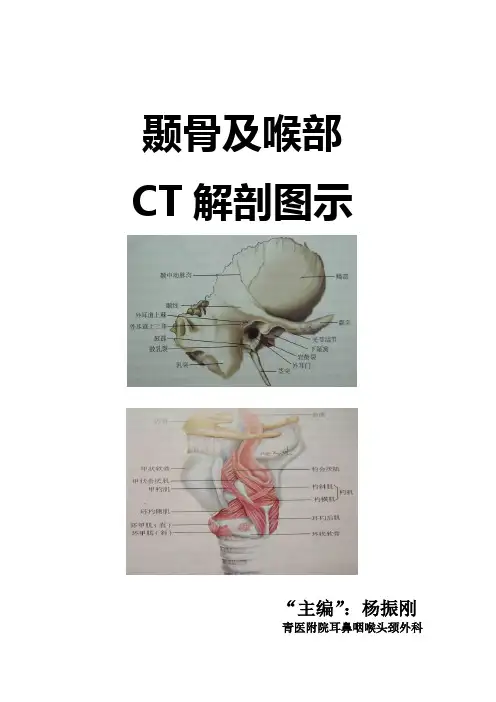 颞骨及喉部CT解剖详解