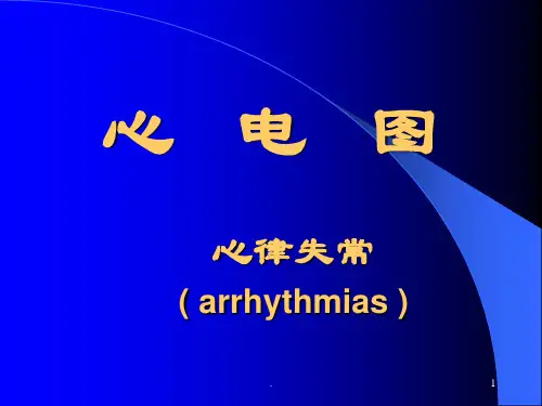 (精品医学)心电图PPT演示课件