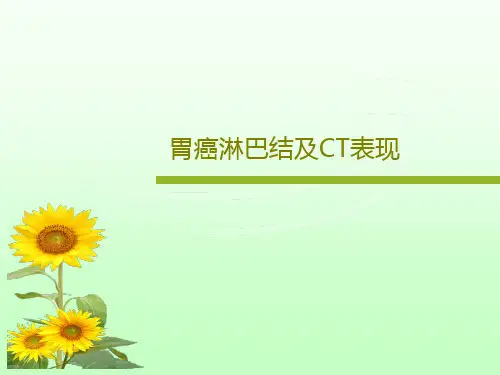 胃癌淋巴结及CT表现17页PPT