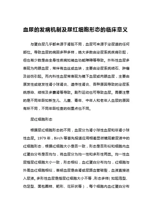 血尿的发病机制及尿红细胞形态的临床意义