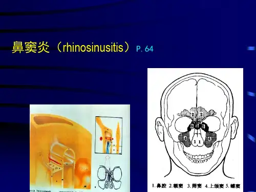 鼻窦炎PPT课件