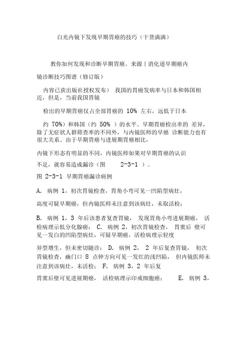 白光内镜下发现早期胃癌的技巧(干货满满)