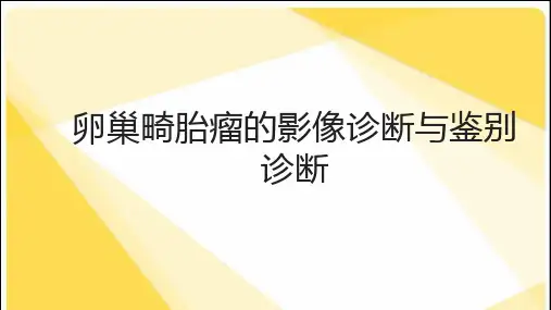卵巢畸胎瘤的影像诊断与鉴别诊断