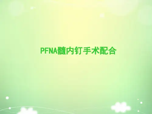 PFNA髓内钉手术配合(1)