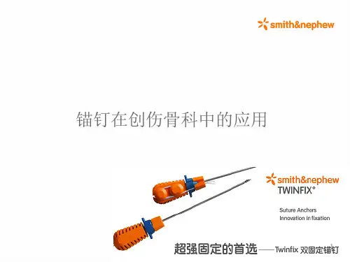 锚钉应用ppt课件