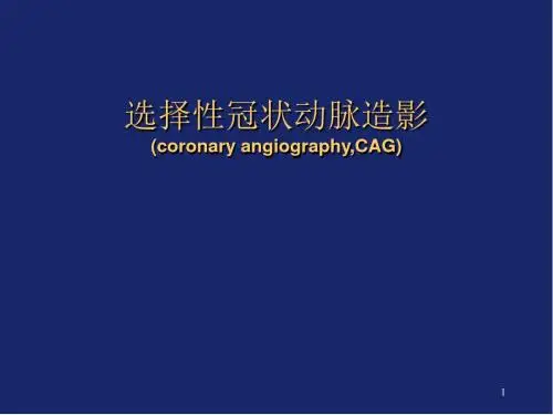 (医学课件)冠状动脉造影PPT幻灯片