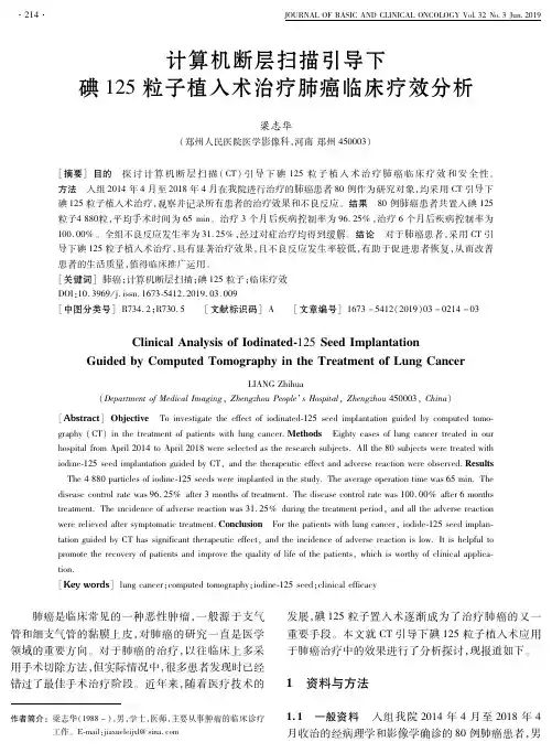 计算机断层扫描引导下碘125粒子植入术治疗肺癌临床疗效分析