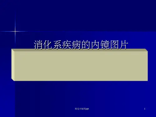 胃镜常见病教学图片