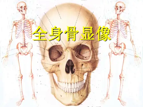 全身骨显像 ppt课件