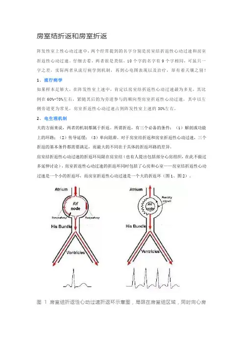 房室结折返和房室折返鉴别