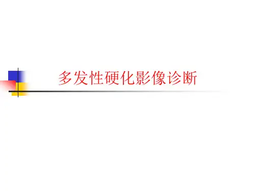 多发性硬化影像诊断