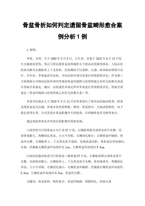 骨盆骨折如何判定遗留骨盆畸形愈合案例分析1例