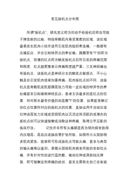 常见扳机点分布图