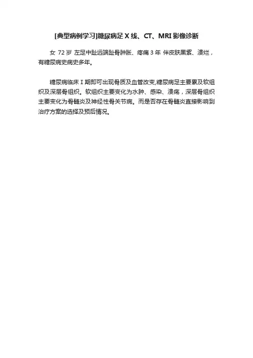 [典型病例学习]糖尿病足X线、CT、MRI影像诊断