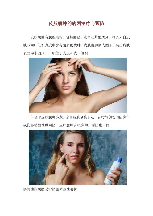 皮肤囊肿的病因治疗与预防