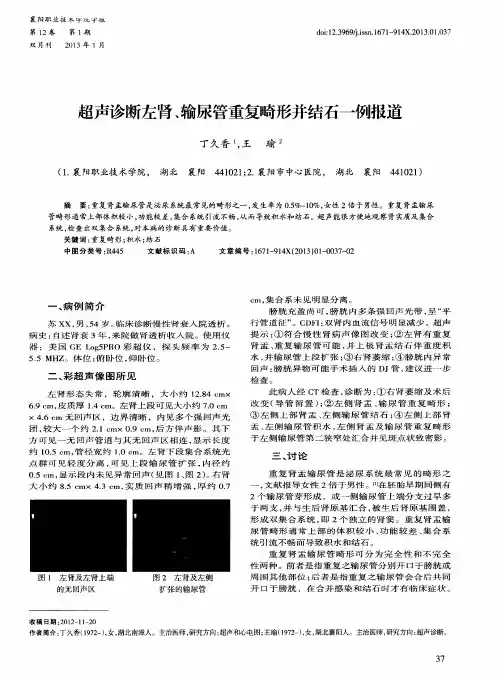 超声诊断左肾、输尿管重复畸形并结石一例报道