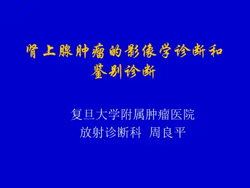 肾上腺肿瘤(医学PPT课件)