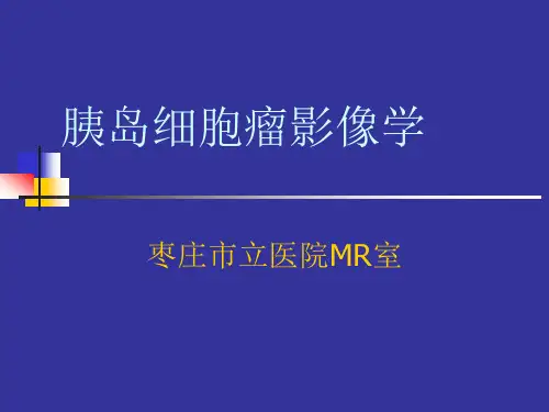 胰岛细胞瘤