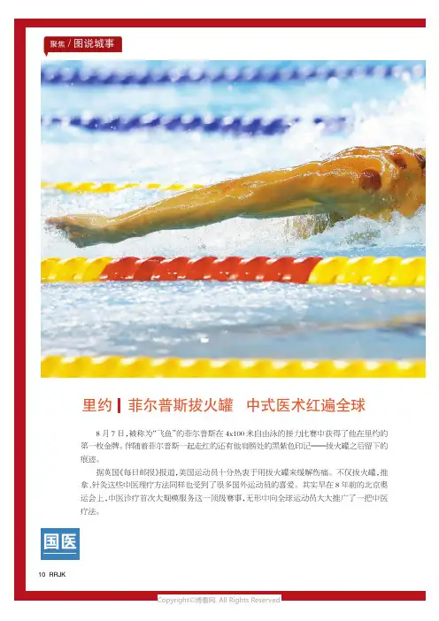 里约｜菲尔普斯拔火罐中式医术红遍全球