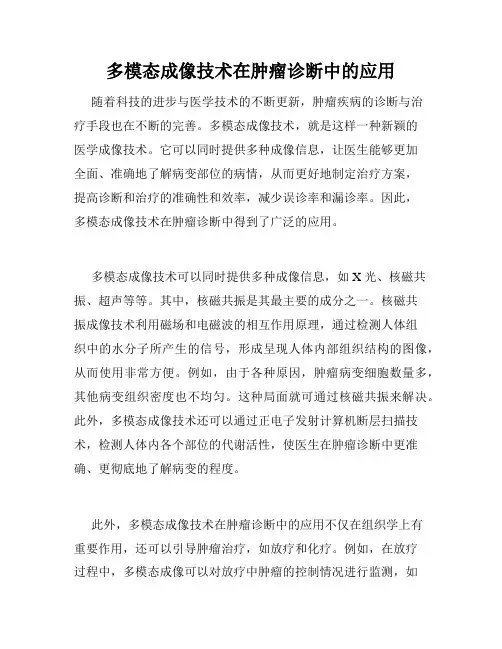 多模态成像技术在肿瘤诊断中的应用