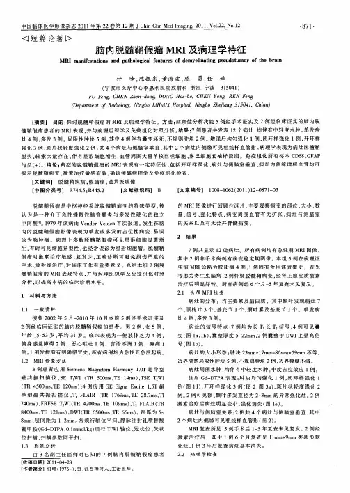脑内脱髓鞘假瘤MRI及病理学特征