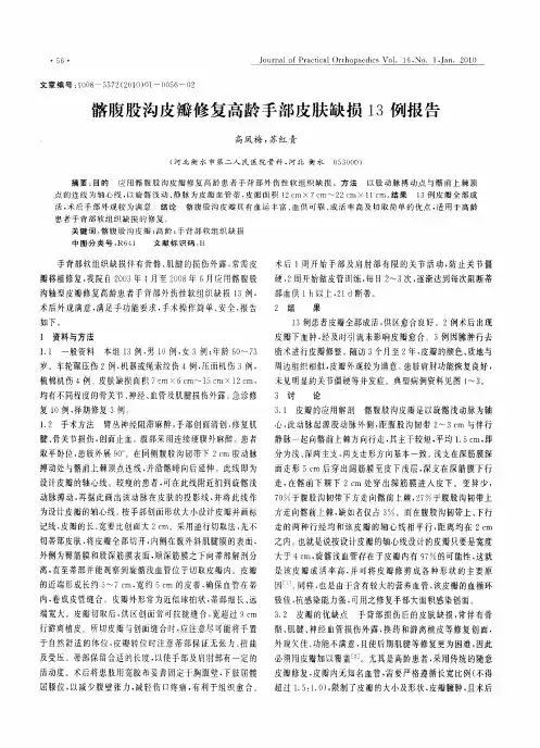 髂腹股沟皮瓣修复高龄手部皮肤缺损13例报告
