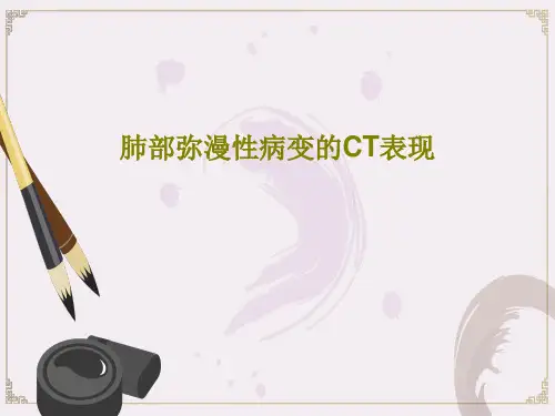 肺部弥漫性病变的CT表现30页PPT