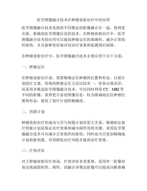 医学图像融合技术在肿瘤放射治疗中的应用