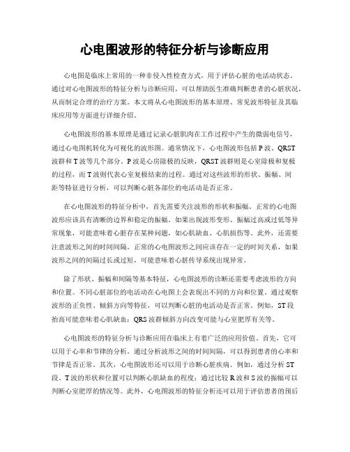 心电图波形的特征分析与诊断应用