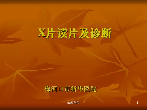 常见X片读片及诊断ppt课件