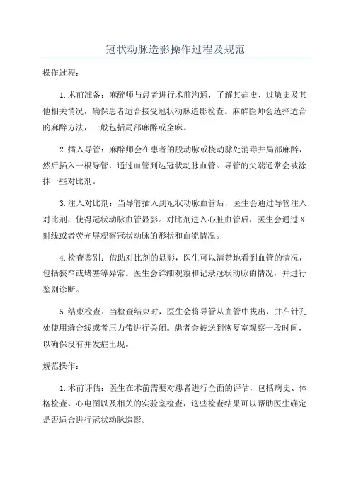 冠状动脉造影操作过程及规范