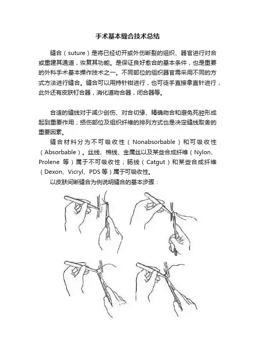 手术基本缝合技术总结