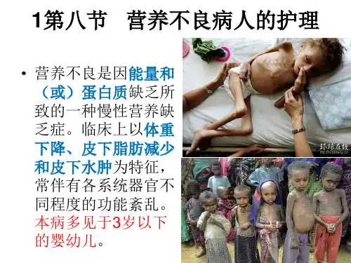 营养不良病人的护理评估及诊断ppt