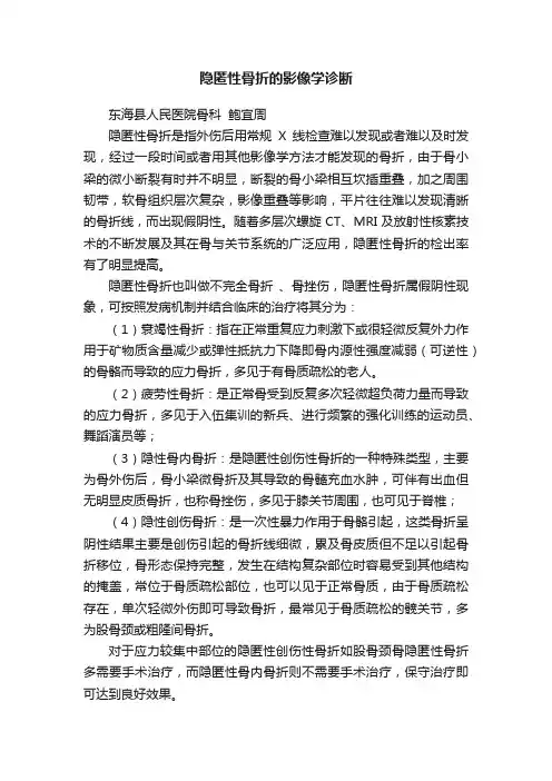 隐匿性骨折的影像学诊断