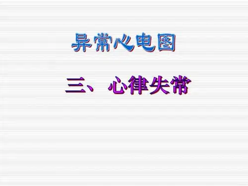 3、-异常心电图图谱汇总[10].