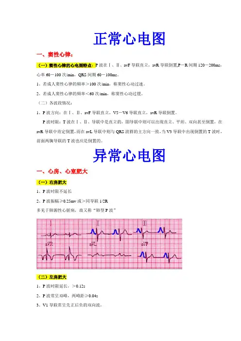 心电图课件WORD版