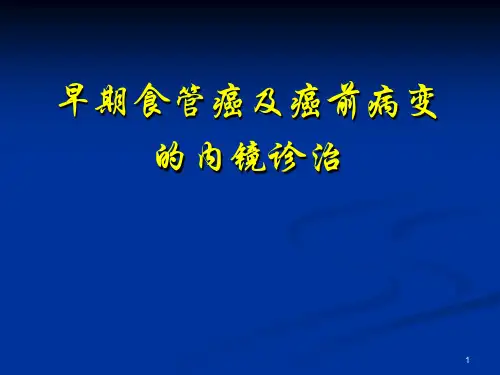 早期食管癌及癌前病变的内镜诊治ppt课件