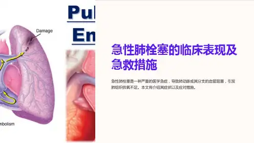 急性肺栓塞的临床表现及急救措施