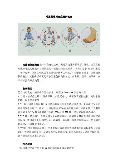 动脉硬化闭塞症健康教育