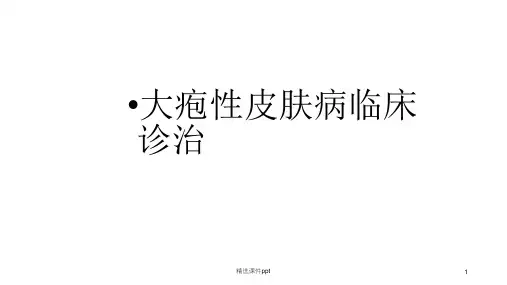 大疱性皮肤病诊治