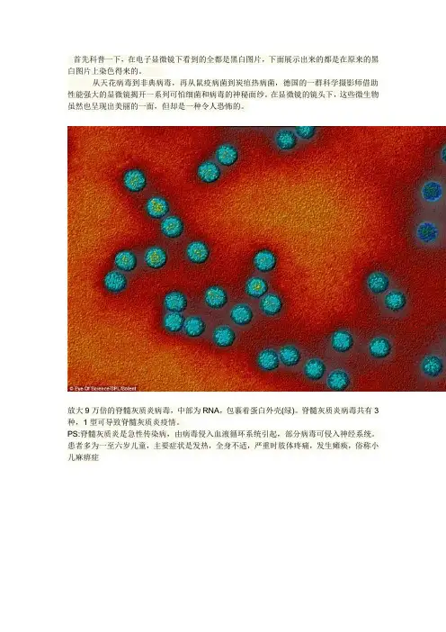 致命的美丽：显微镜下的细菌和病毒(14P)