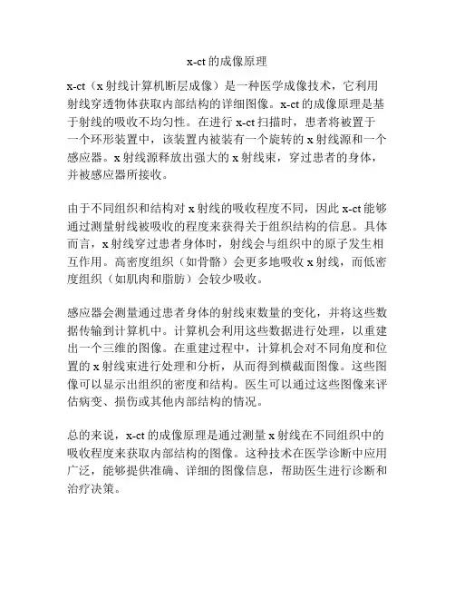 x-ct的成像原理
