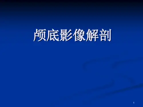 颅底影像解剖PPT演示幻灯片