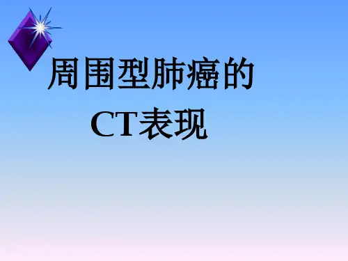 周围型肺癌的ct表现课件