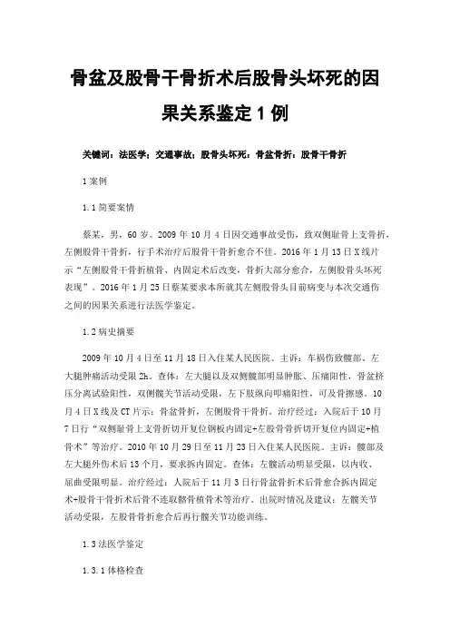 骨盆及股骨干骨折术后股骨头坏死的因果关系鉴定1例