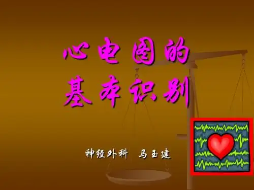 心电图基本知识