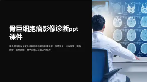 骨巨细胞瘤影像诊断课件
