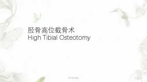 胫骨高位截骨术PPT课件